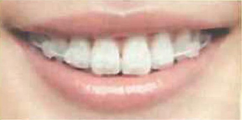 orthodontics-img01