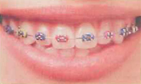 orthodontics-img04