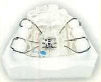 orthodontics-img05