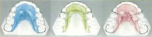 orthodontics-img07